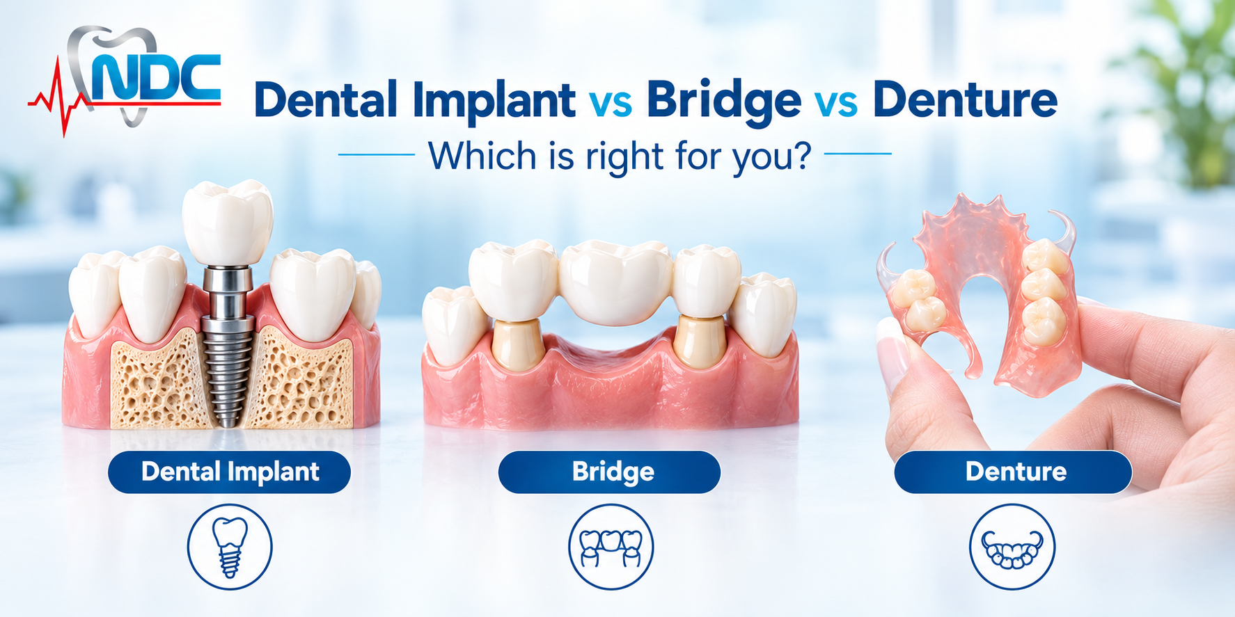 Dental implant vs bridge vs denture: which is right for you?